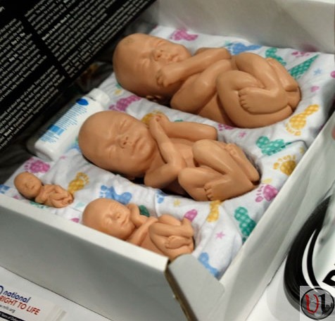 abortion-pro-life 1